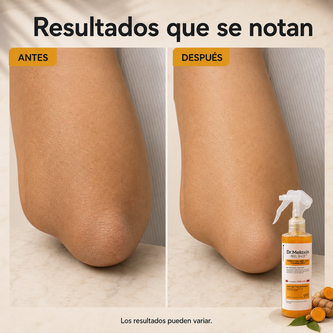 Antes y despues - resultados que se notan